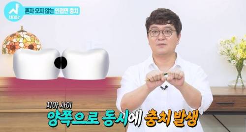 [스압] 치과의사들 "쓰읍" 소리나게 한다는 충치