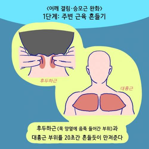 [스압] 목이나 어깨 아플 때 절대 주무르면 안 되는 부위