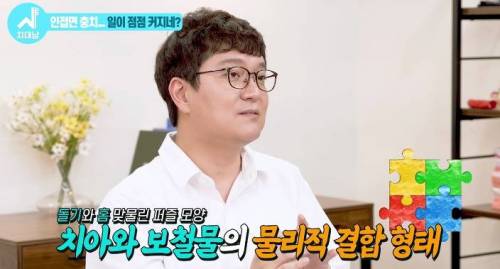 [스압] 치과의사들 "쓰읍" 소리나게 한다는 충치