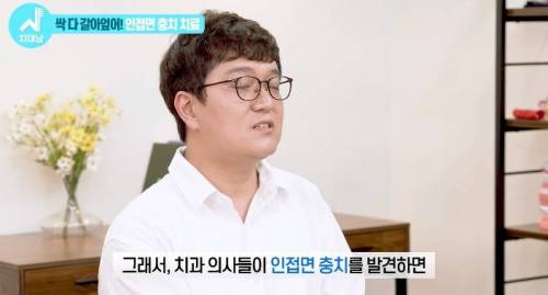 [스압] 치과의사들 "쓰읍" 소리나게 한다는 충치