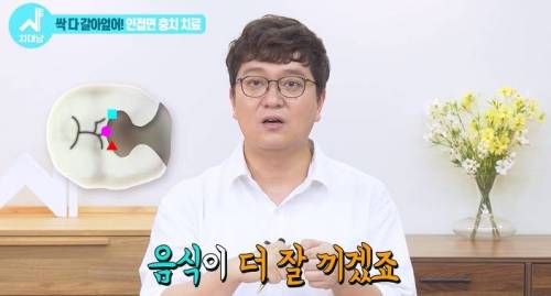 [스압] 치과의사들 "쓰읍" 소리나게 한다는 충치