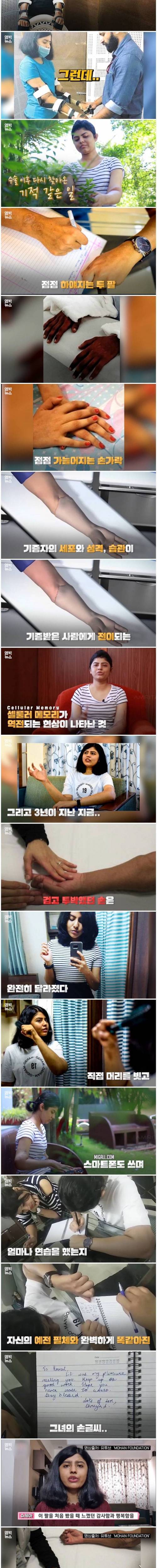 [스압] 남자 팔 이식 받은 소녀에게 나타난 놀라운 변화