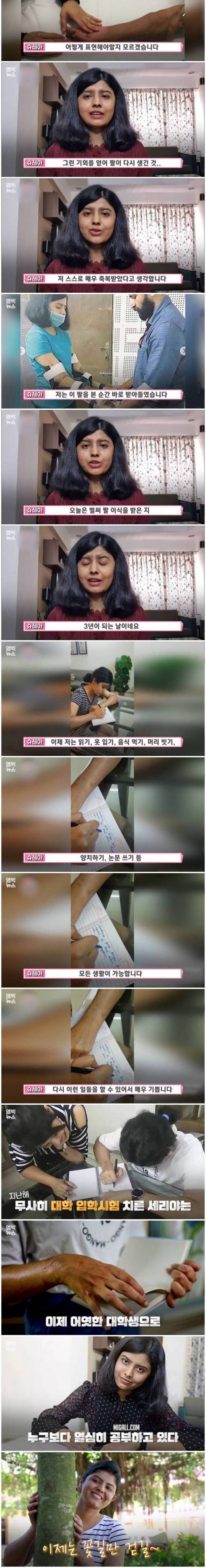 [스압] 남자 팔 이식 받은 소녀에게 나타난 놀라운 변화