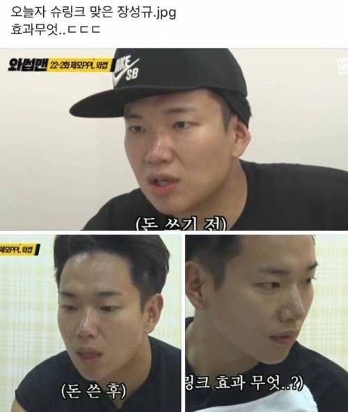 장성규 시술 전 후.jpg