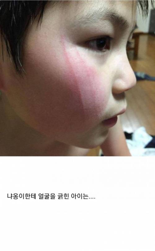 고양이한테 얼굴을 긁힌 아이가 한 행동