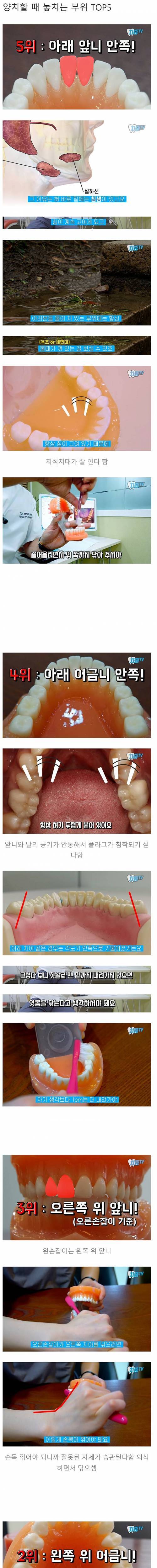 [스압]양치할 때 놓치는 부위.jpg