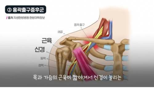 [스압] 팔을 위로 올리고 잠자는 사람들 건강이 위험한 이유.jpg