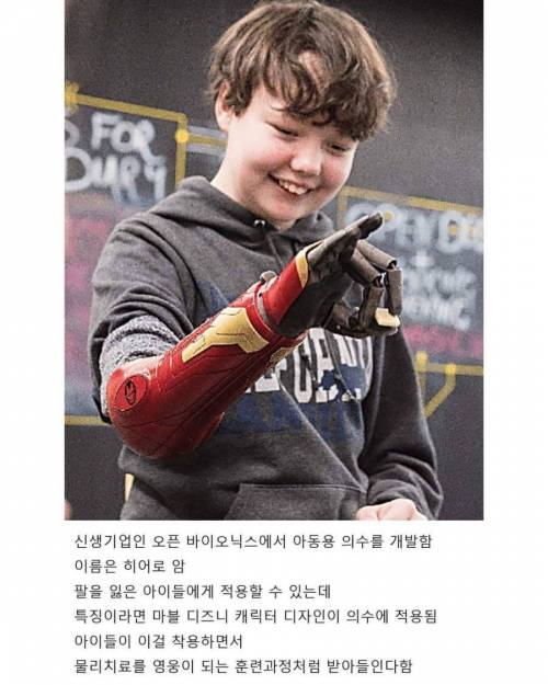 어린이 인공의수 근황.jpg