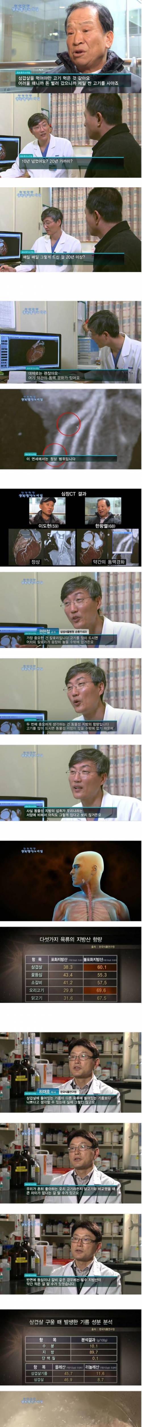 [스압] 삼겹살 20년동안 매일같이 먹은 사람의 몸 상태.jpg