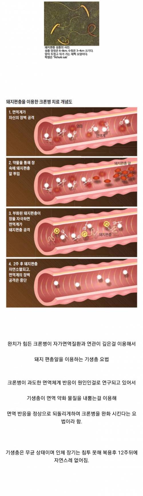 현대의학이 기생충을 사용하는 방법