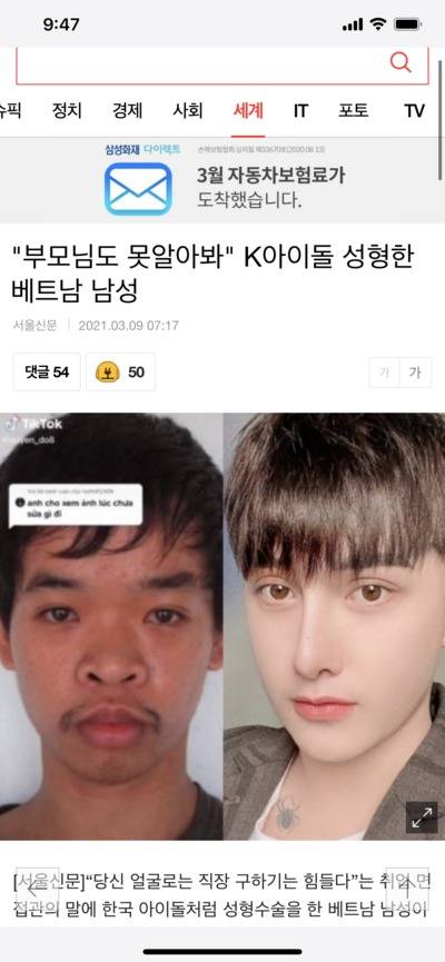 성형 전후 레전드....jpg