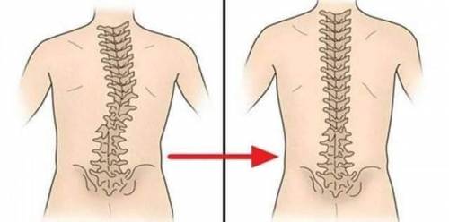 의사들이 실제로 권장하는 1분 허리 스트레칭