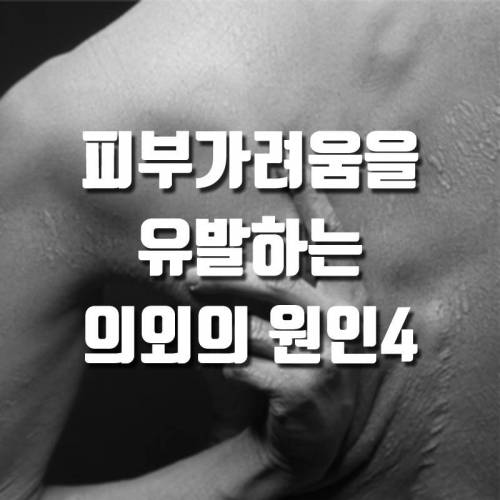 피부가려움을 유발하는 의외의 원인4.jpg