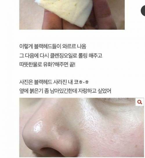 블랙헤드 없애는 법.jpg