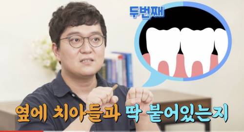 [스압] 빠진 치아 방치하면 생기는 일