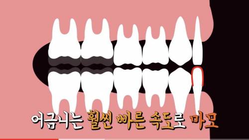 [스압] 빠진 치아 방치하면 생기는 일