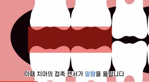 [스압] 빠진 치아 방치하면 생기는 일