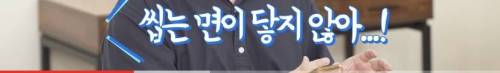 [스압] 빠진 치아 방치하면 생기는 일