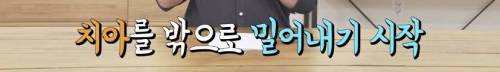 [스압] 빠진 치아 방치하면 생기는 일