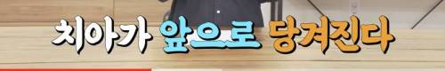 [스압] 빠진 치아 방치하면 생기는 일