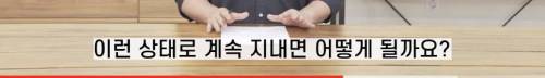 [스압] 빠진 치아 방치하면 생기는 일