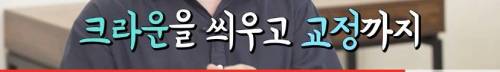 [스압] 빠진 치아 방치하면 생기는 일