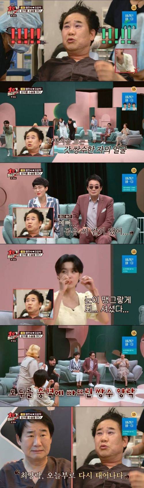 [스압] 최양락 쌍수 직후 & 10일차 눈을 본 후배 개그맨들 반응.jpg