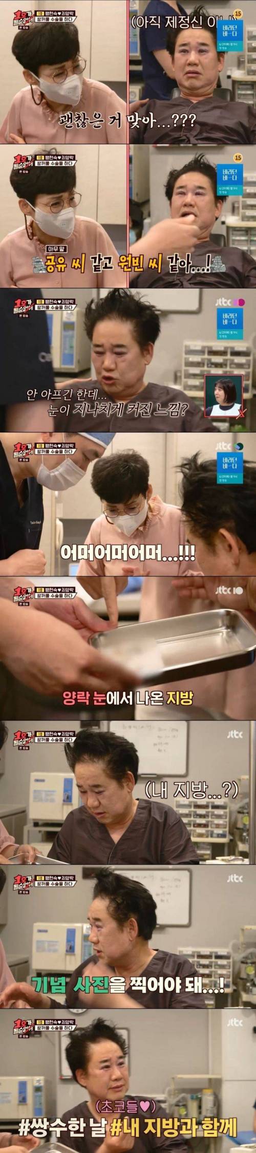 [스압] 최양락 쌍수 직후 & 10일차 눈을 본 후배 개그맨들 반응.jpg