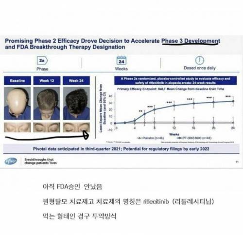 화이자가 신의 섭리를 거스르는 중.jpg