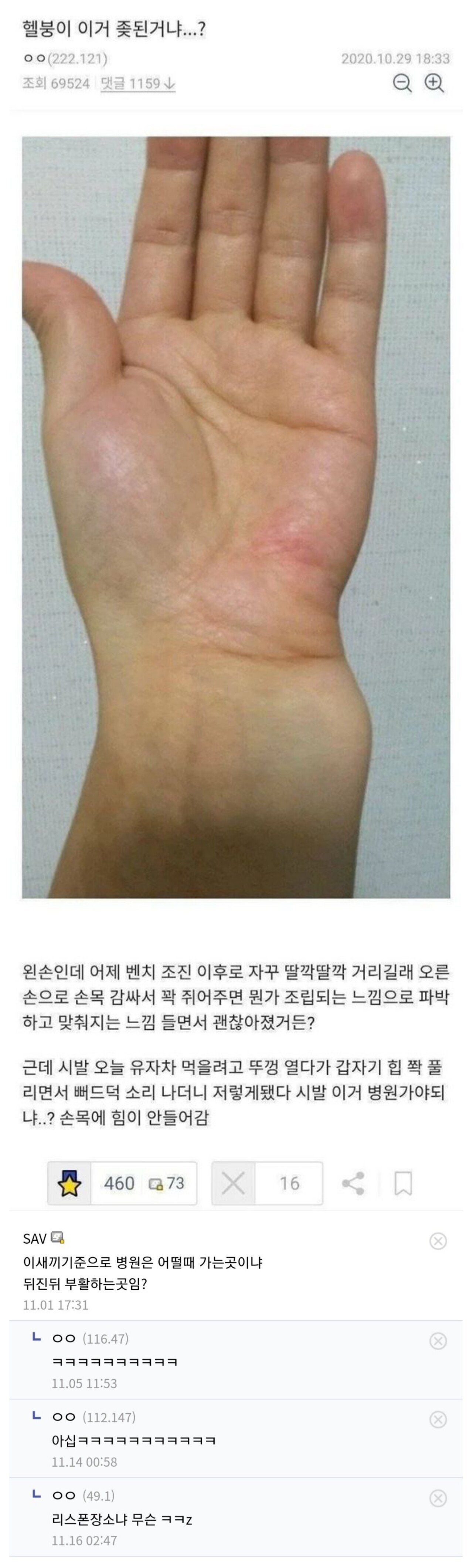 [스압] 손목브레이커를 본 응급의학과 교수님