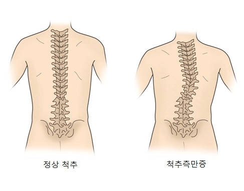 발병 원인이 잘못 알려진 질병.jpg