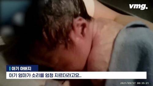 [스압] 고속도로 터널 안에서 숨 안쉬는 아기가 태어난 긴급상황