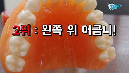 [스압] 양치할 때 놓치는 부위 TOP 5