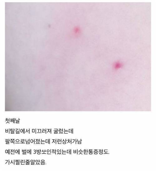 [스압] 산책하다 독사에게 물림.jpg