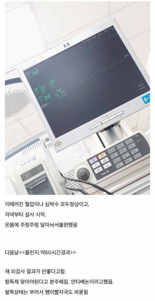 [스압] 산책하다 독사에게 물림.jpg