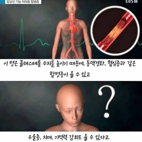 여성 100명중 10명은 걸린다는 병 .jpg