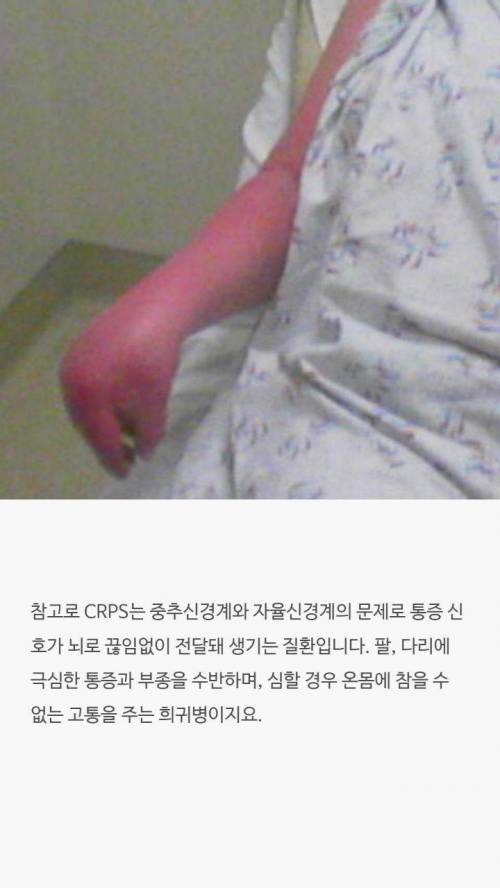 [스압] 점수로 보는 통증순위.jpg