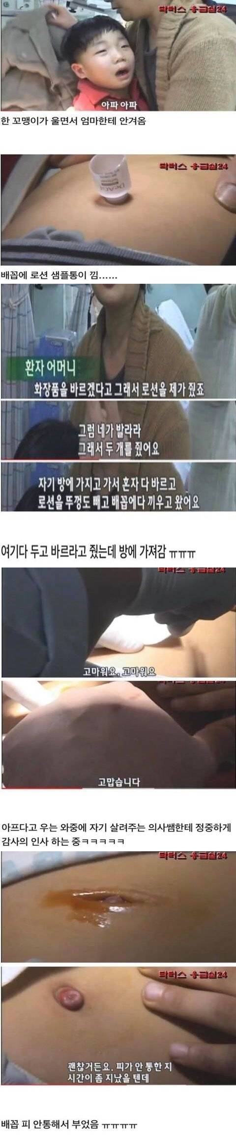 배꼽에 로션통이 낀 아이