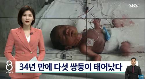 국내 34년 만에 다섯 쌍둥이 출산 ㄷㄷㄷ.jpg