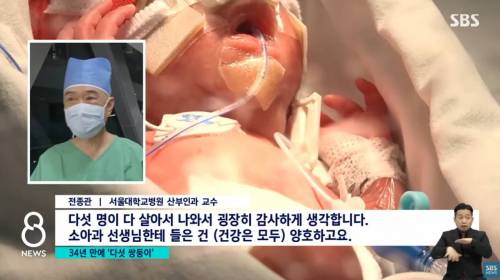 국내 34년 만에 다섯 쌍둥이 출산 ㄷㄷㄷ.jpg