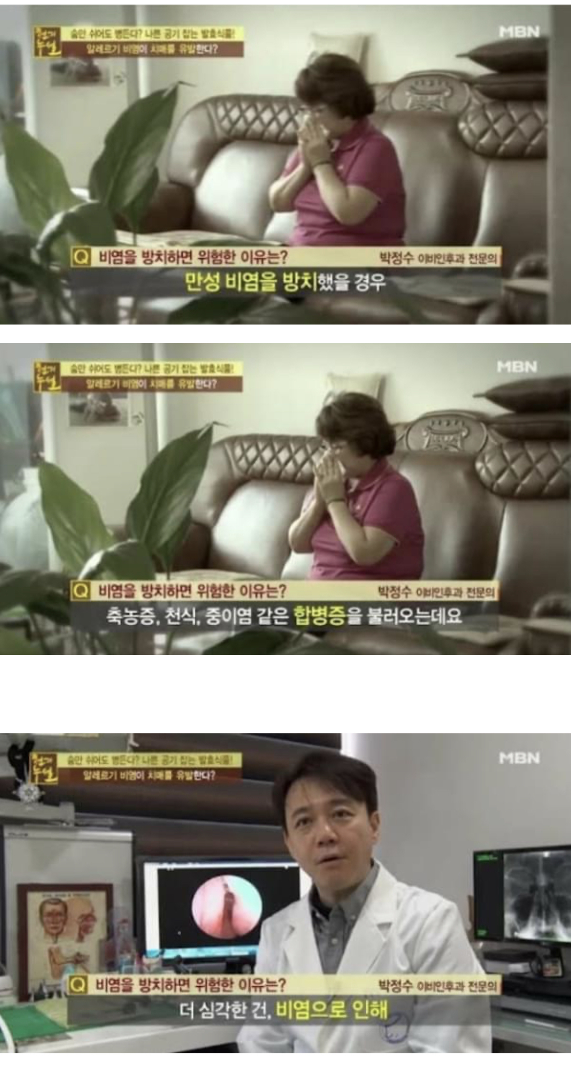 [스압] 비염 방치하면 절대 안되는 이유.jpg