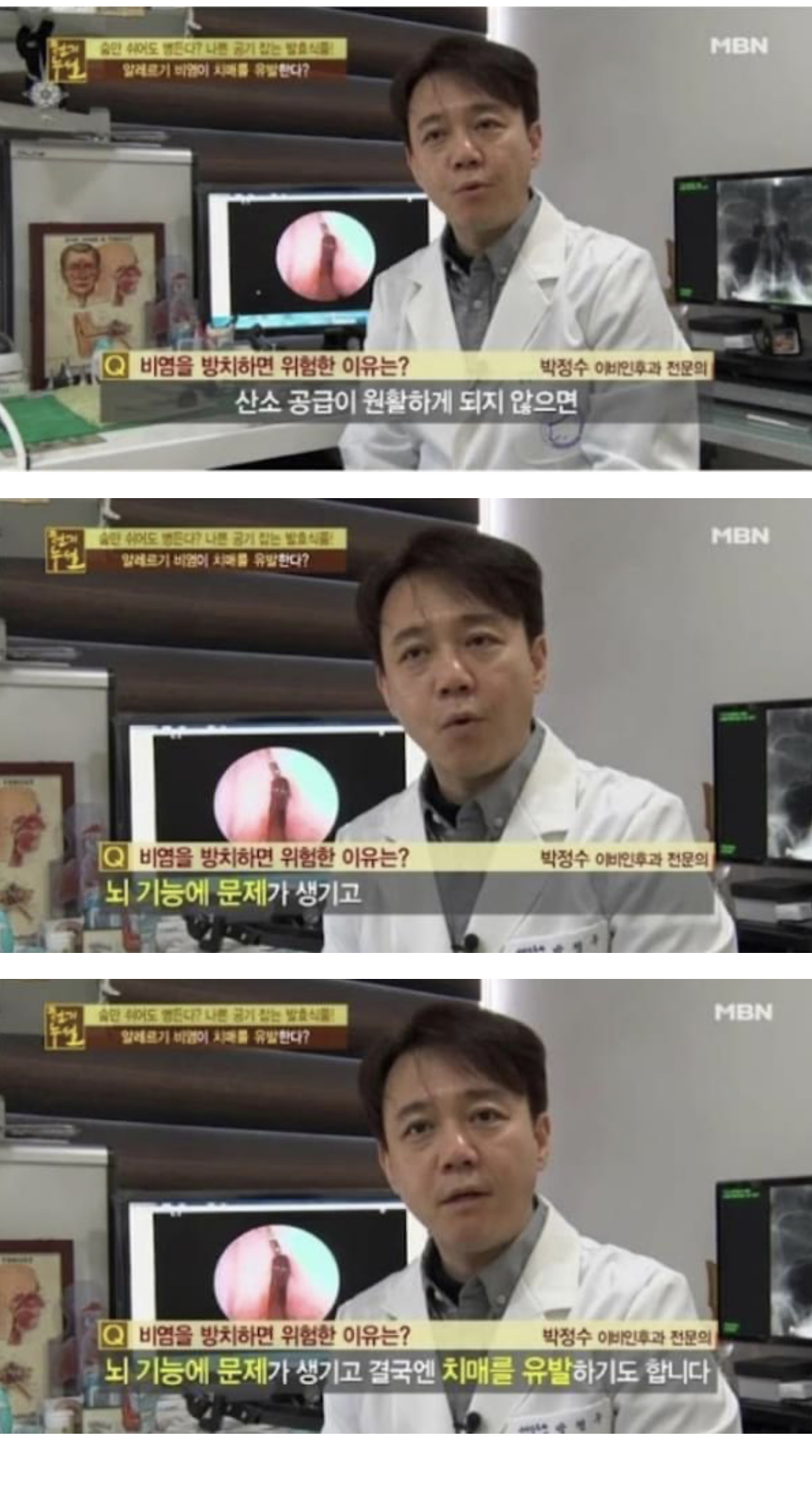 [스압] 비염 방치하면 절대 안되는 이유.jpg