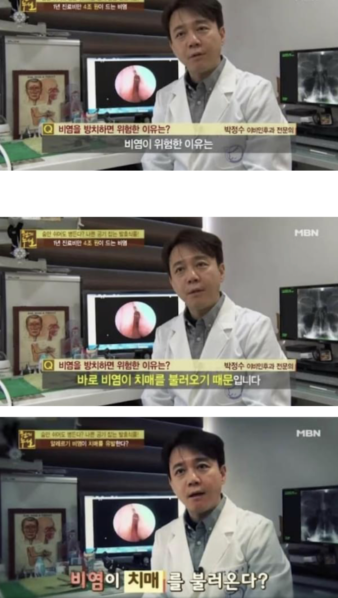 [스압] 비염 방치하면 절대 안되는 이유.jpg