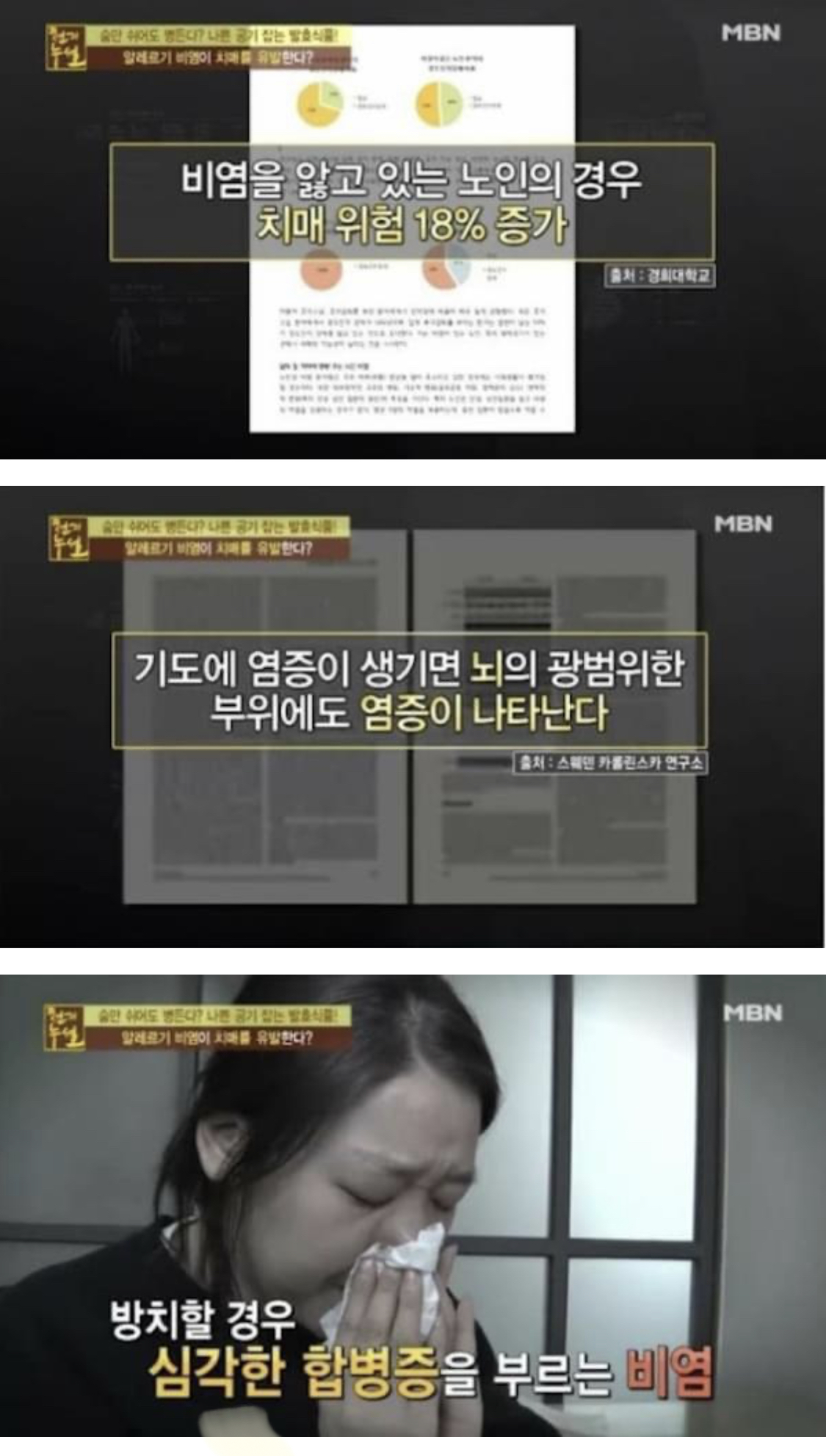 [스압] 비염 방치하면 절대 안되는 이유.jpg