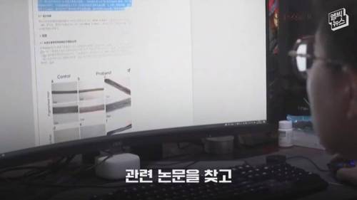 [스압] 멘케스증후군 2살 아들 위해 신약을 개발해버린 아빠