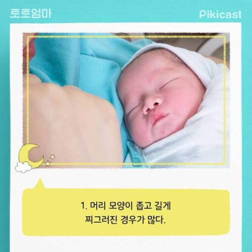 [스압] 갓 태어난 아기의 몸이 신기한 이유