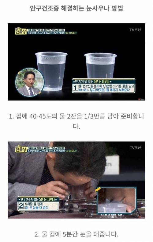 하루 5분 " 안구건조증 " 싹 낫게해주는 "눈사우나"