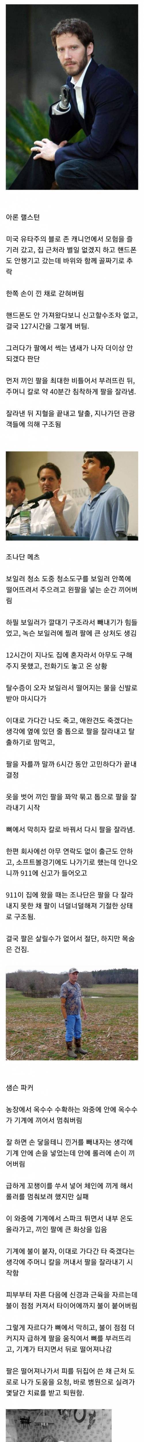 [스압] 살기 위해 스스로 팔을 잘라낸 사람들.jpg