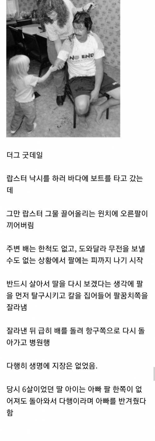 [스압] 살기 위해 스스로 팔을 잘라낸 사람들.jpg