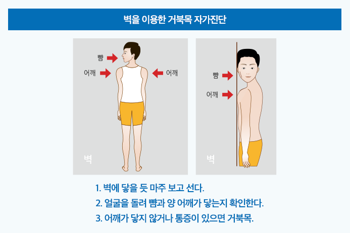 거북목 자가진단 법.jpg